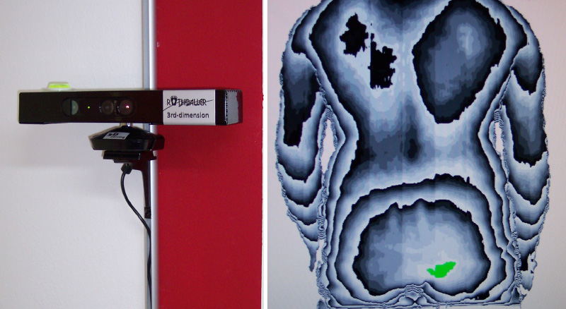3D Rückenscanner